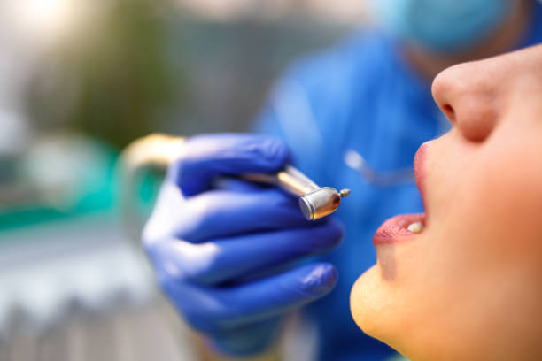 Best Veneers and Lumineers  in Mirrormont, WA